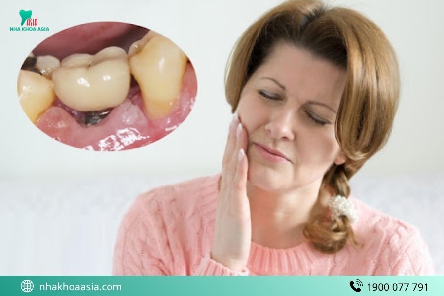 4 Mẹo giảm đau sau trồng Implant