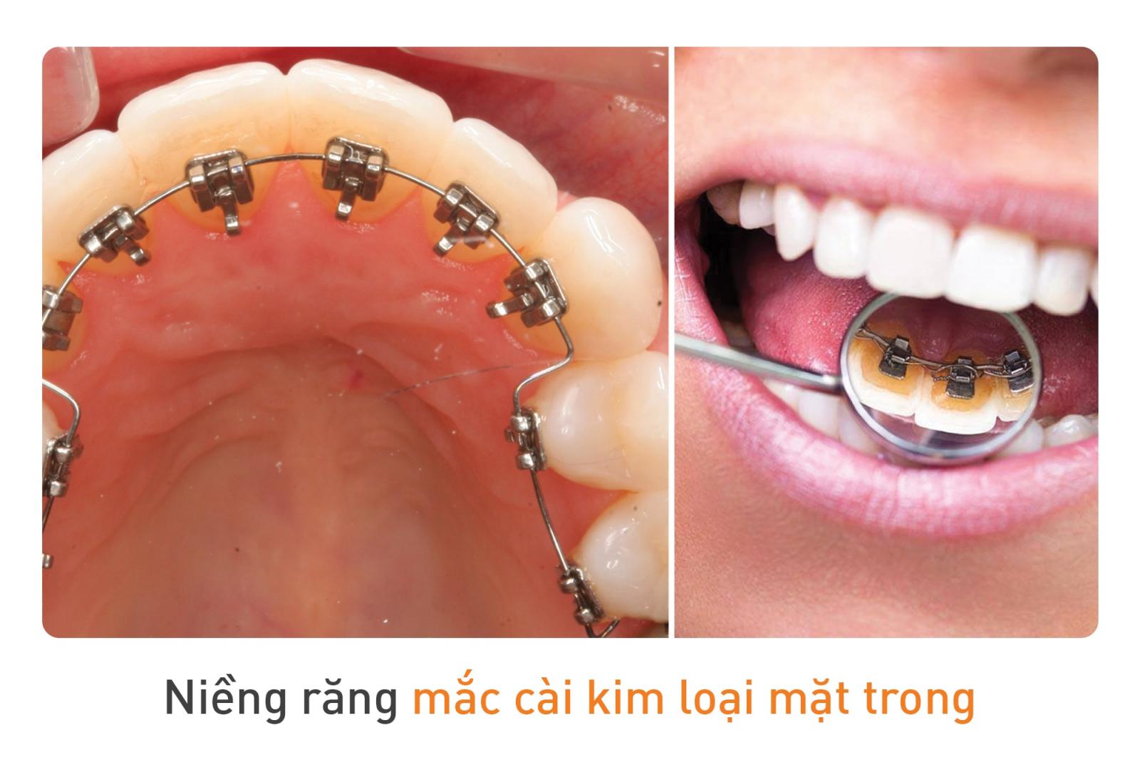 Nguyên nhân dẫn đến hô hàm nhẹ