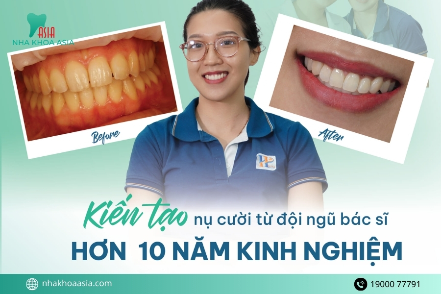 Tẩy trắng răng ở đâu uy tín, bền đẹp? Chi phí tẩy trắng răng 2026 bao nhiêu?