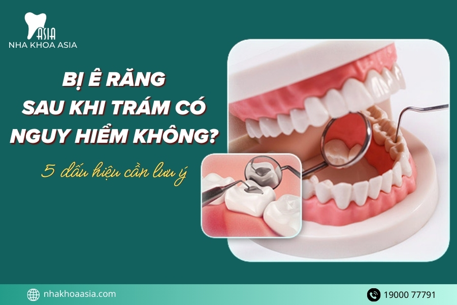 Bị ê răng sau khi trám có sao không? 5 cách xử lý tại nhà