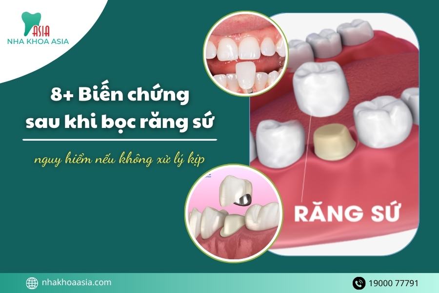 Biến chứng sau khi bọc răng sứ nguy hiểm nếu không xử lý kịp