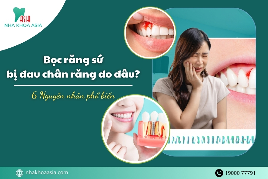 Bọc răng sứ bị đau chân răng do đâu? 6 Nguyên nhân phổ biến