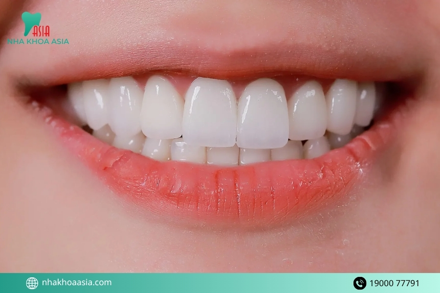 Bọc răng sứ bị đau chân răng phải xử lý như thế nào?
