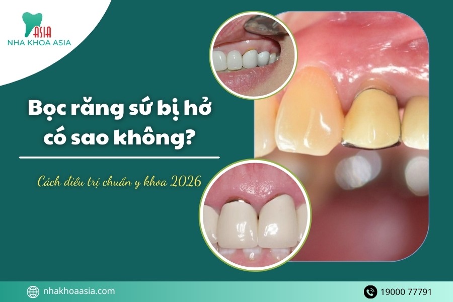 Nha khoa Asia - Địa chỉ bọc răng sứ uy tín nhất khu vực TP.HCM