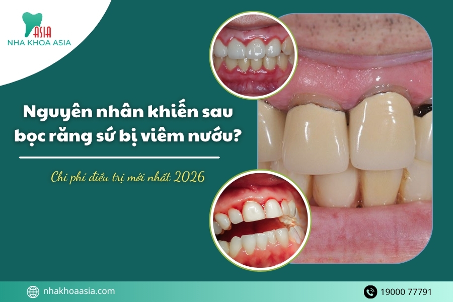 Bọc răng sứ bị viêm nướu có nguy hiểm không? 