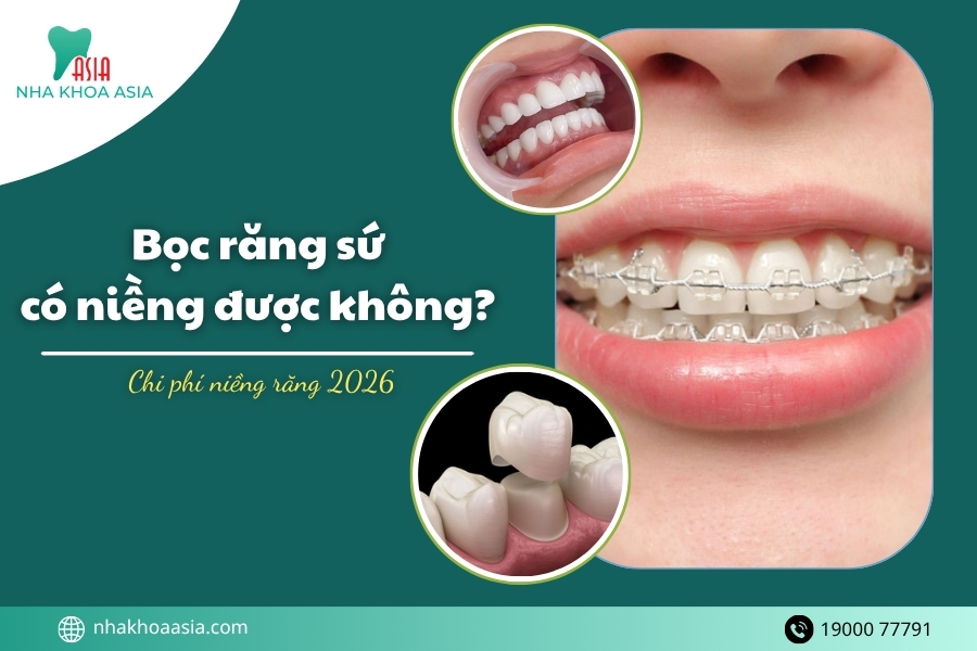 Bọc răng sứ có niềng được không? Chi phí niềng răng 2026