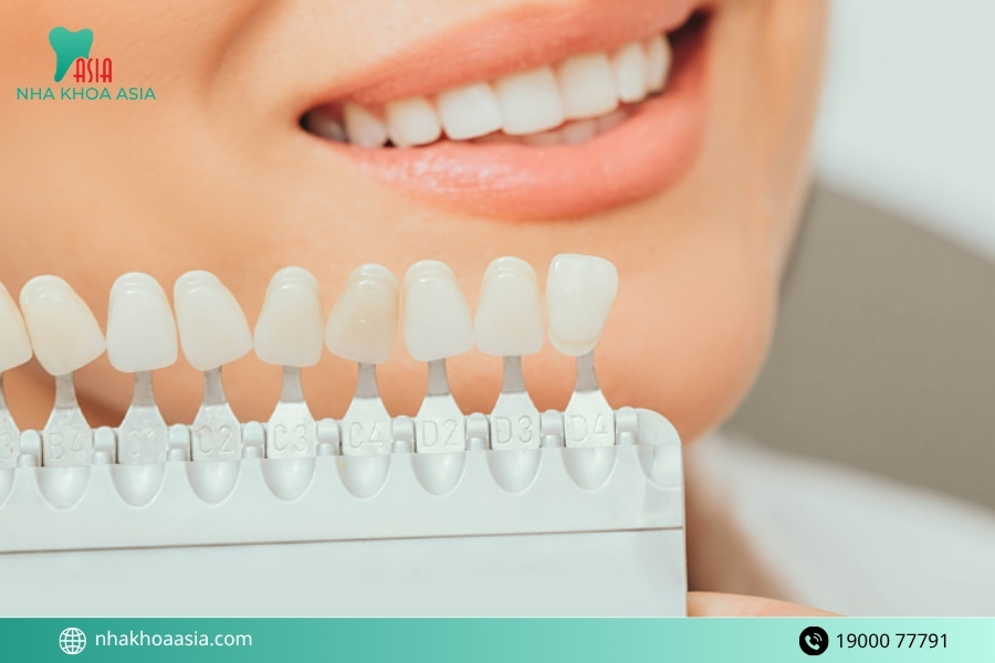 Những loại răng bọc sứ phổ biến và chất lượng nhất 2026