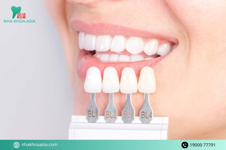 Những loại răng bọc sứ phổ biến và chất lượng nhất 2026