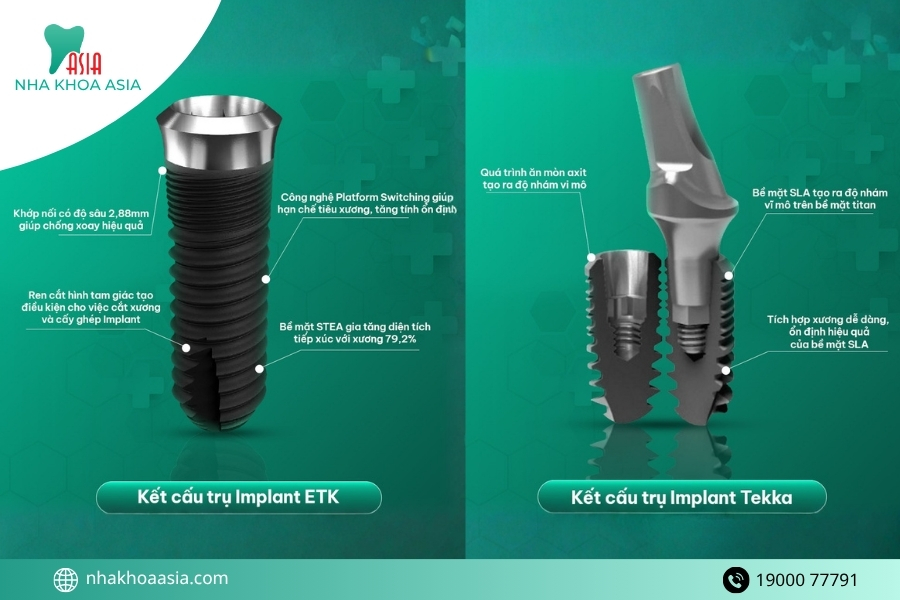 Các loại trụ cấy implant răng hàm phổ biến hiện nay