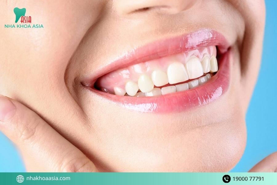 Các phương pháp chữa cười hở lợi phổ biến hiện nay
