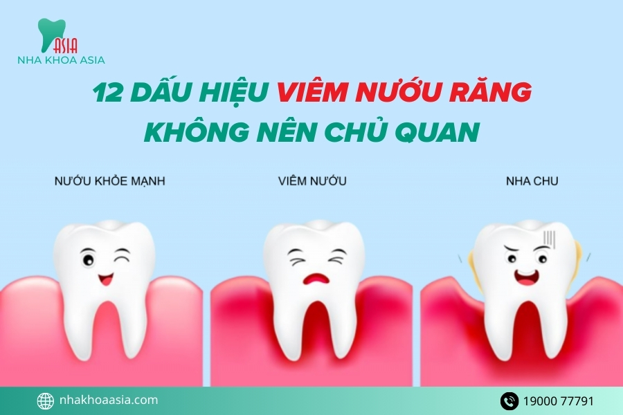 Mách Bạn 12 Dấu Hiệu Viêm Nướu Răng Không Nên Chủ Quan