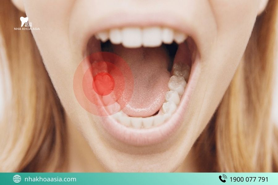 Đau nhức sau trồng Implant có nguy hiểm không