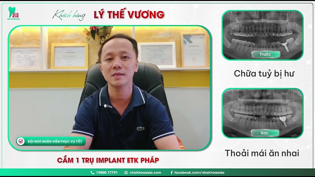 trong-rang-Implant-khong-dau