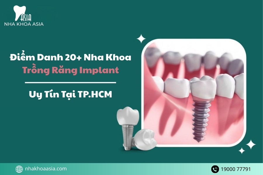 Danh Sách 20+ Nha Khoa Trồng Răng Implant Uy Tín Tại TP.HCM