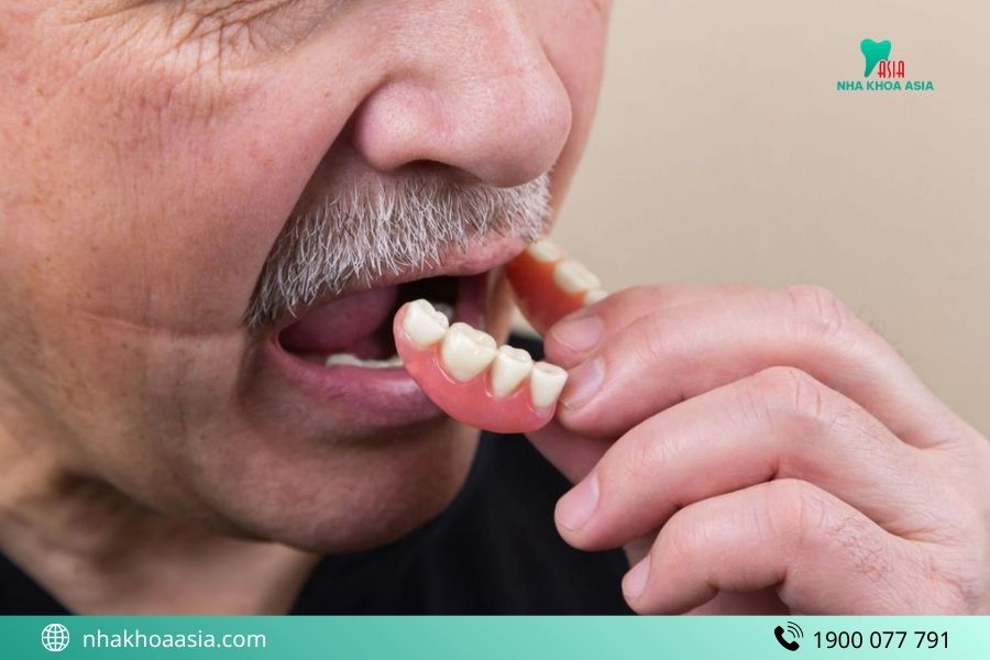 hàm giả tháo lắp có bền không