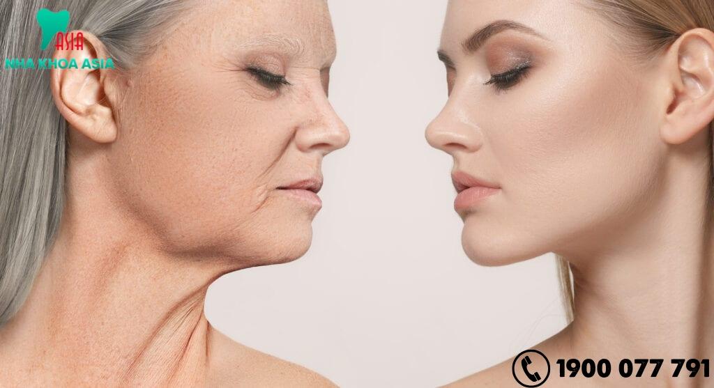 Tuổi tác khiến đường viền hàm mất đi sự sắc nét do quá trình lão hóa