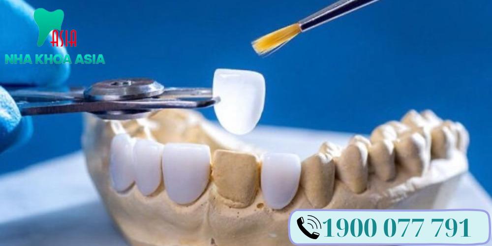Keo dán hàm giả có tác dụng gắn kết và giữ chặt hàng giả