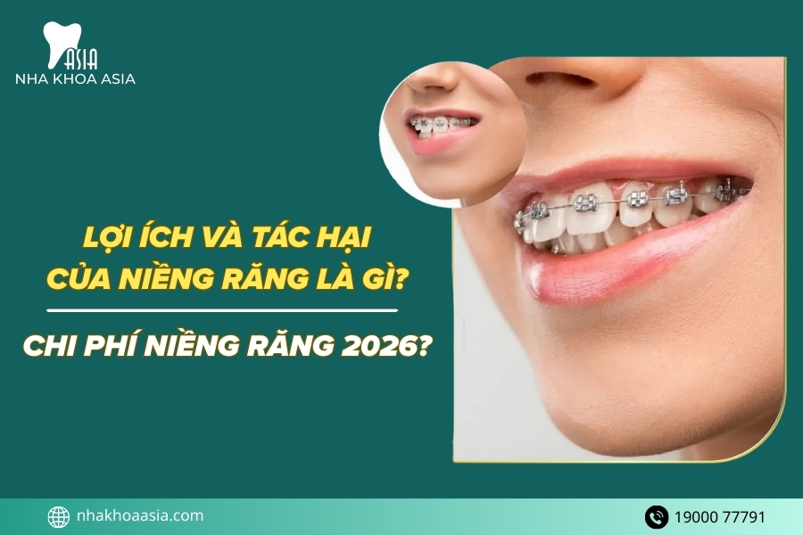 Lợi ích và tác hại của niềng răng là gì? Chi phí bao nhiêu?