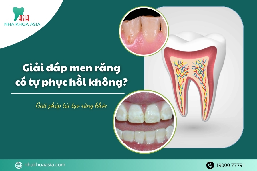 Giải đáp men răng có tự phục hồi không? Giải pháp tái tạo răng khỏe