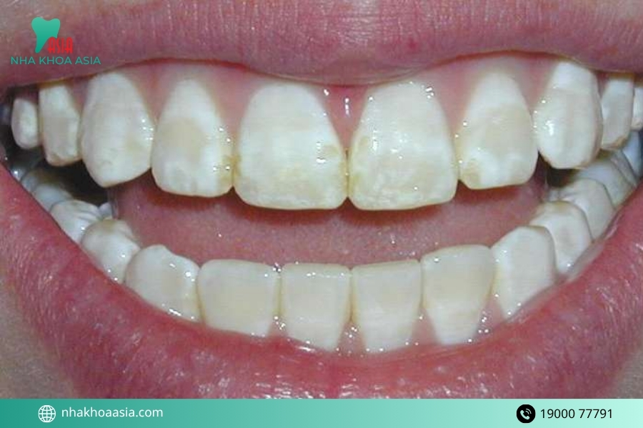 Men răng có tự phục hồi không?