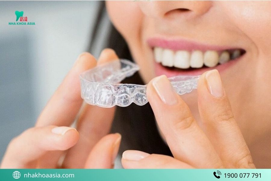 Nên niềng trong suốt hay mắc cài