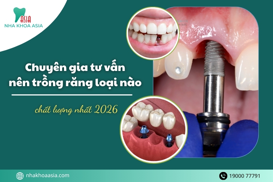 3 phương pháp trồng răng phổ biến nhất hiện nay