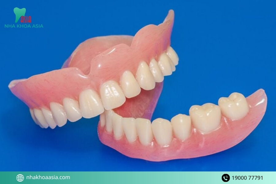 3 phương pháp trồng răng phổ biến nhất hiện nay