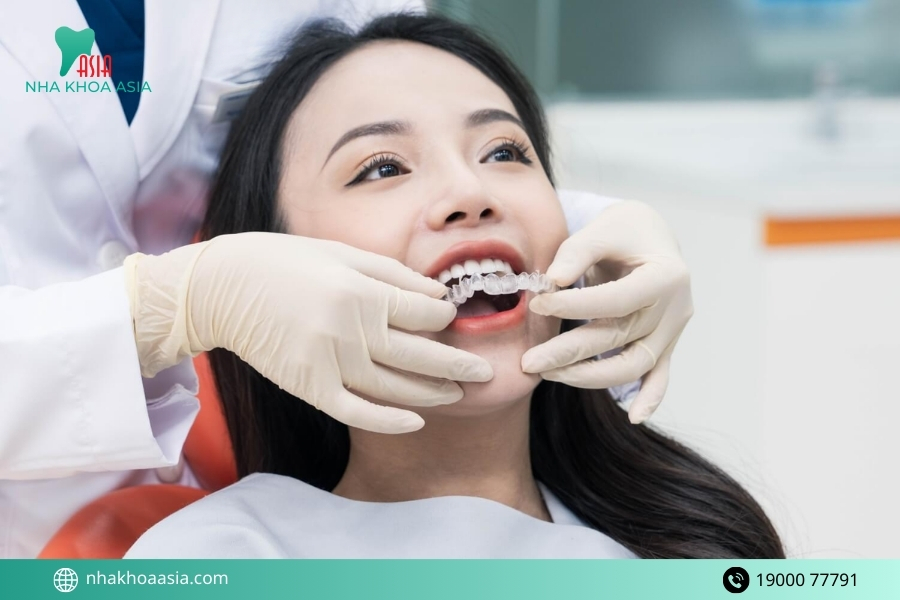 5 Trường hợp cần nhổ răng khôn trước khi niềng răng