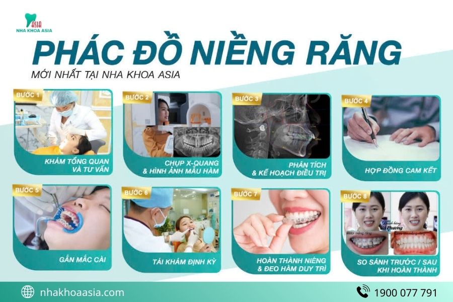Niềng răng ở đâu uy tín TP.HCM