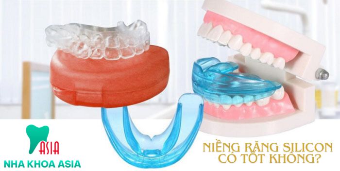 Niêng răng silicon có hiệu quả không?