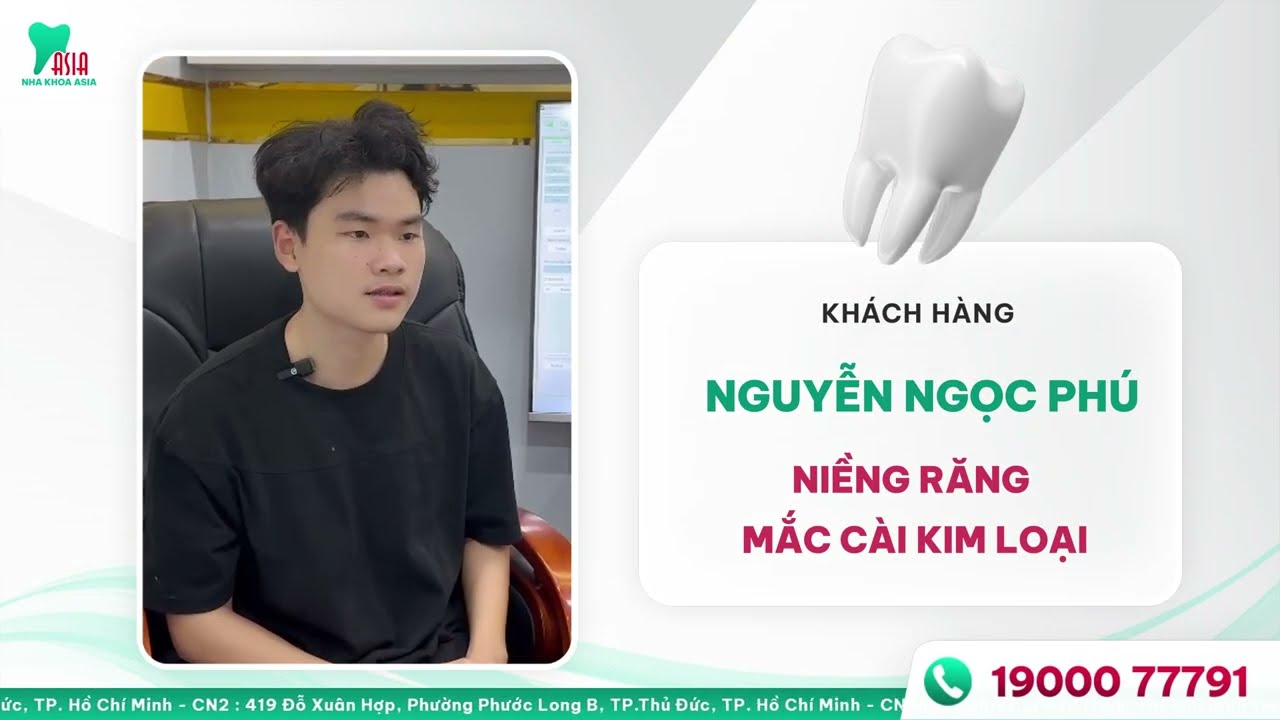 Niềng răng là gì?
