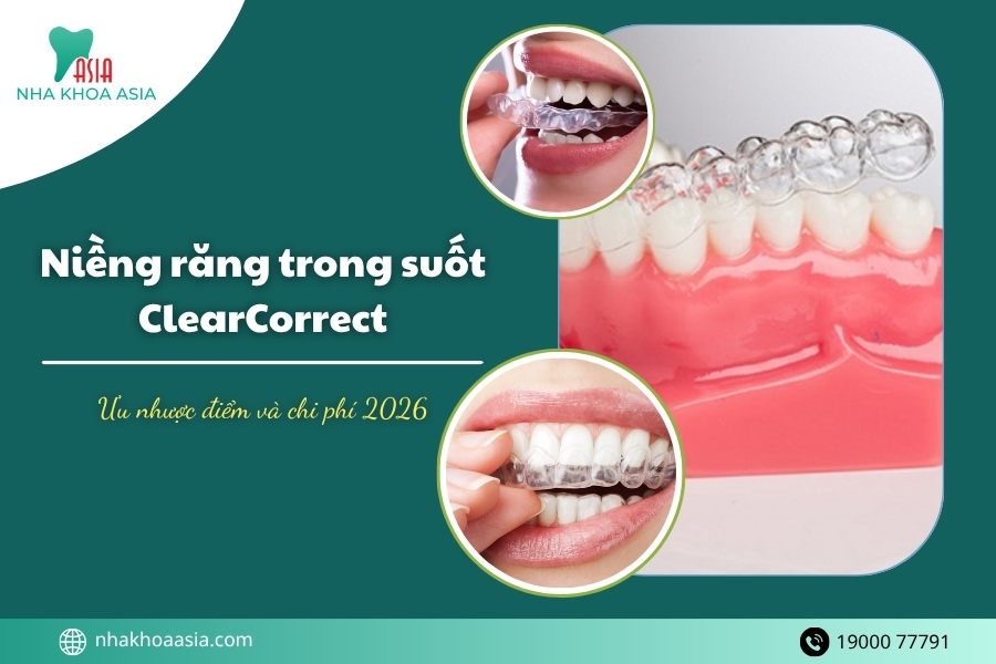 Niềng răng trong suốt ClearCorrect: Ưu - nhược điểm và chi phí 2026