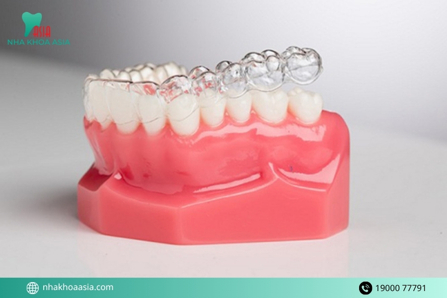 Niềng răng trong suốt ClearCorrect là gì?