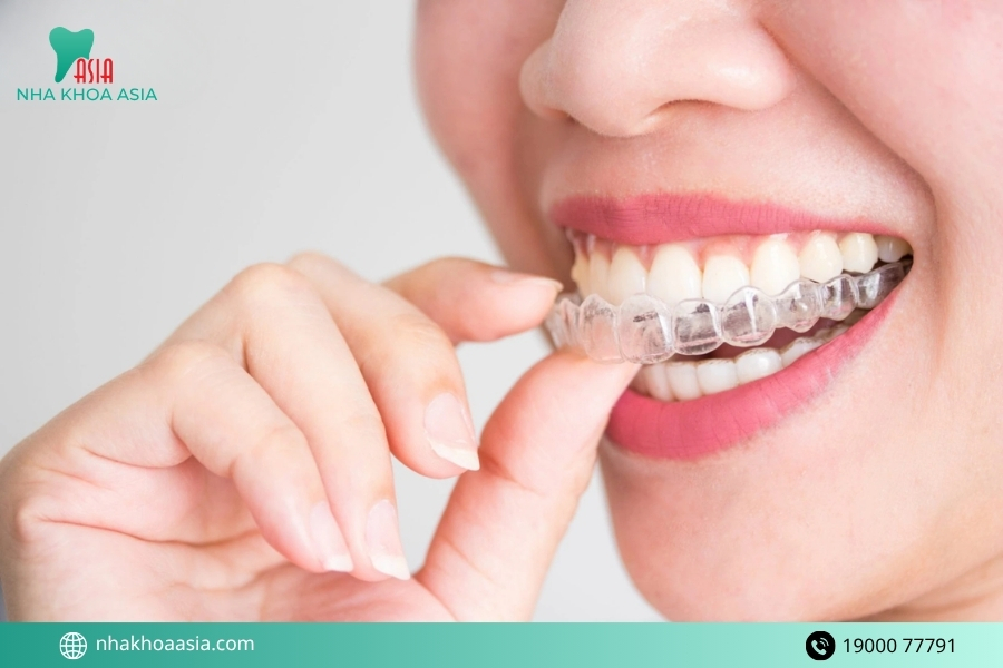 Ưu điểm của niềng răng trong suốt ClearCorrect