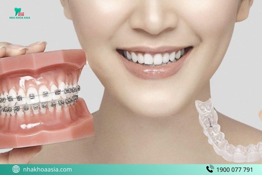Niềng răng trong suốt có ăn được không?