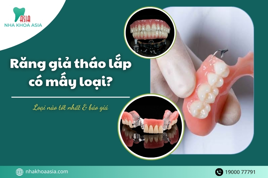 Răng giả tháo lắp có mấy loại? Loại nào tốt nhất & báo giá 2026