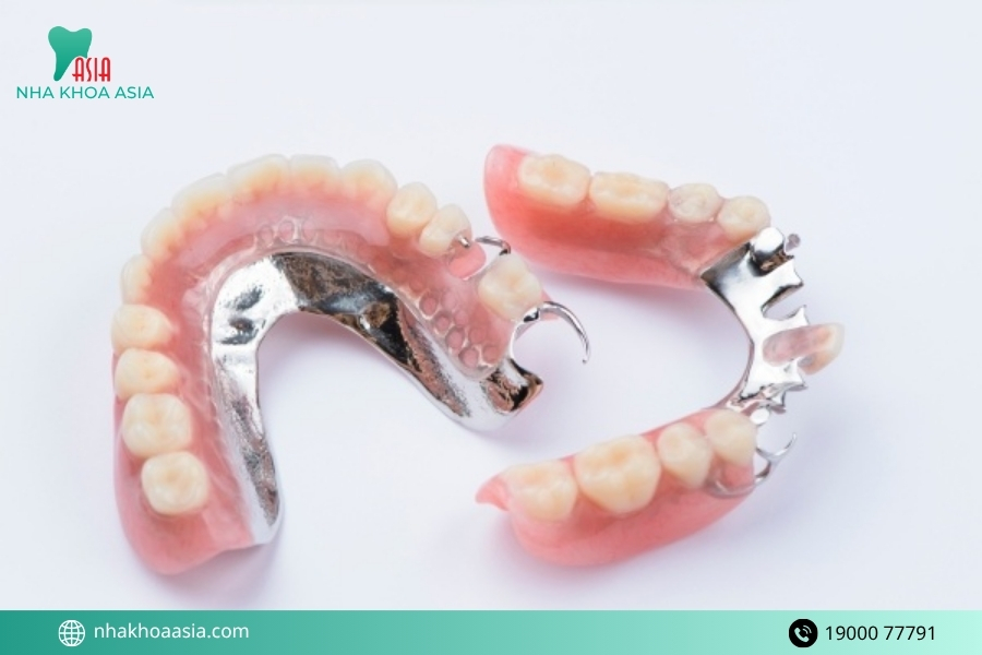 Răng giả tháo lắp có mấy loại?