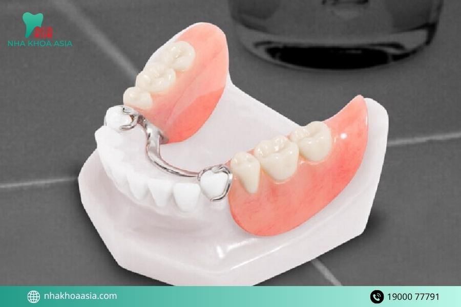 Răng giả tháo lắp có mấy loại?