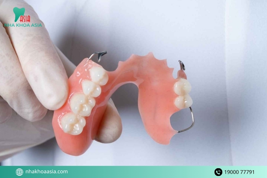 Nên dùng răng giả tháo lắp hay trồng răng sứ cố định?