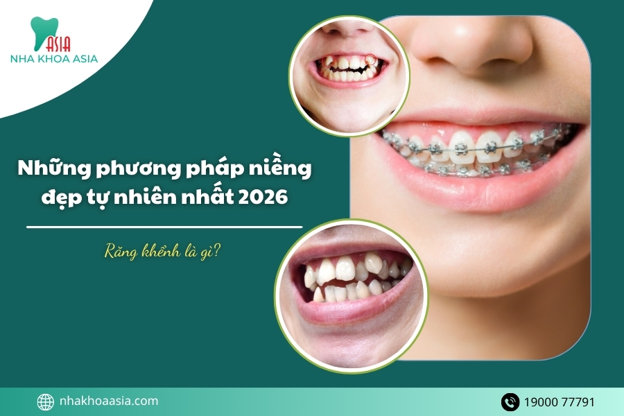 Răng khểnh là gì? Những phương pháp niềng đẹp tự nhiên nhất 2026