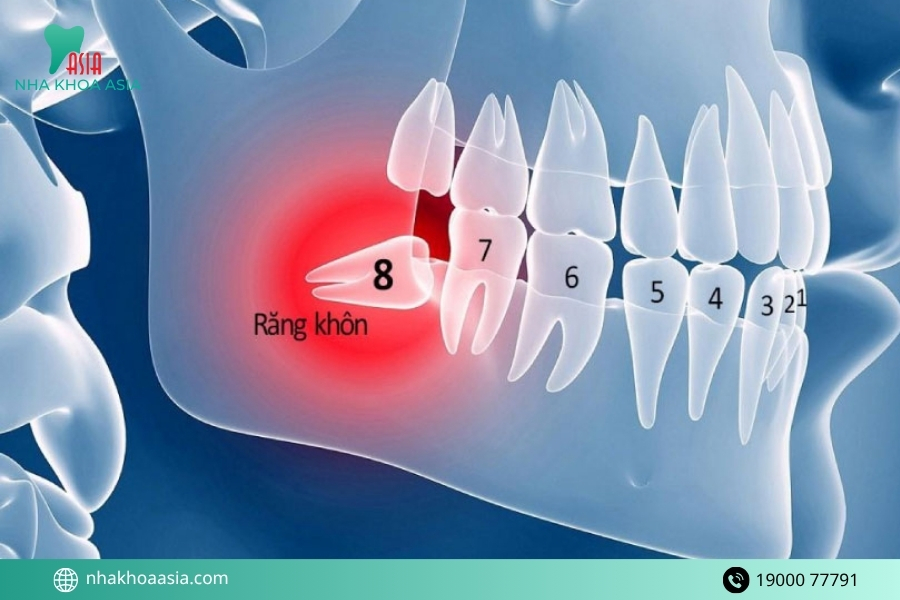 Răng khôn là răng ở đâu? Cách xác định vị trí răng số 8