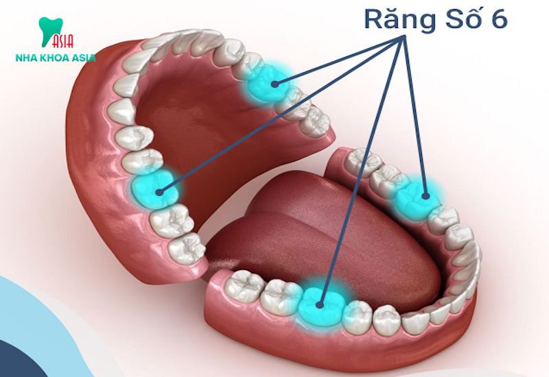 Răng số 6 là gì?