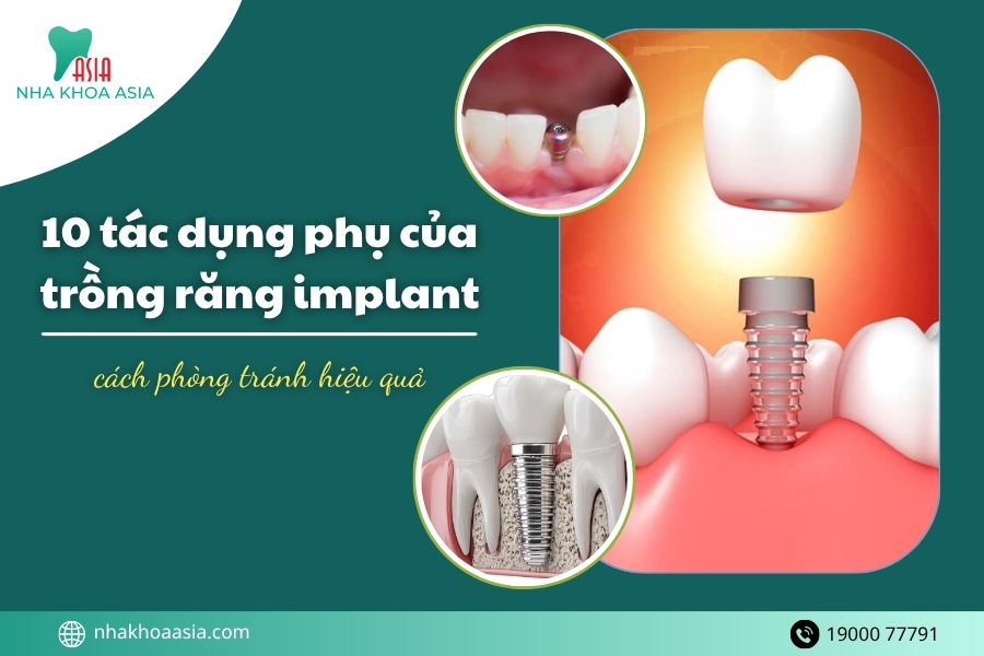 10 tác dụng phụ của trồng răng implant và cách phòng tránh hiệu quả nhất