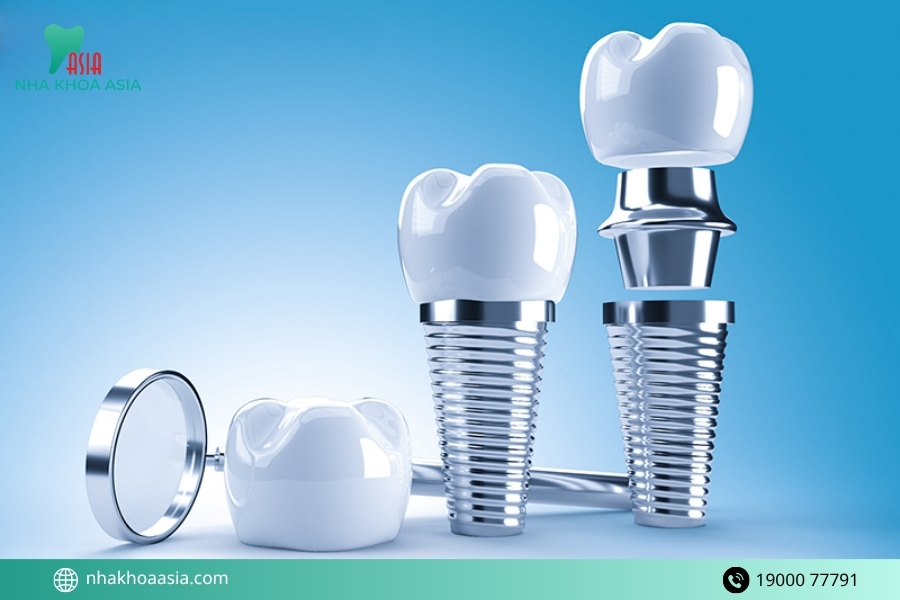 Tác dụng phụ của trồng răng implant bạn cần biết