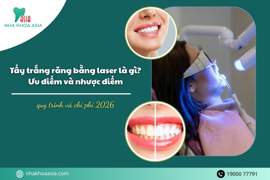 Tẩy trắng răng bằng laser là gì?