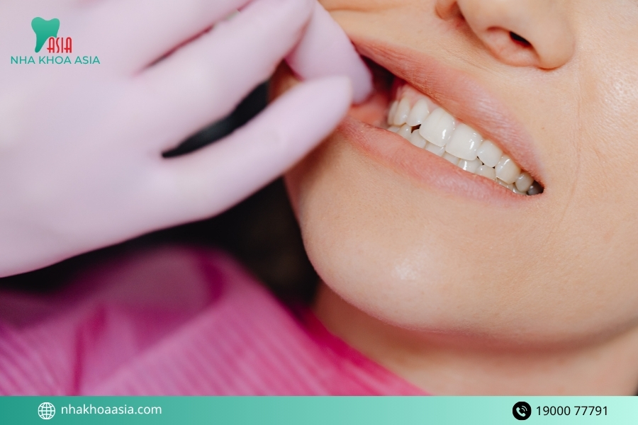 Nhược điểm tẩy trắng răng bằng laser