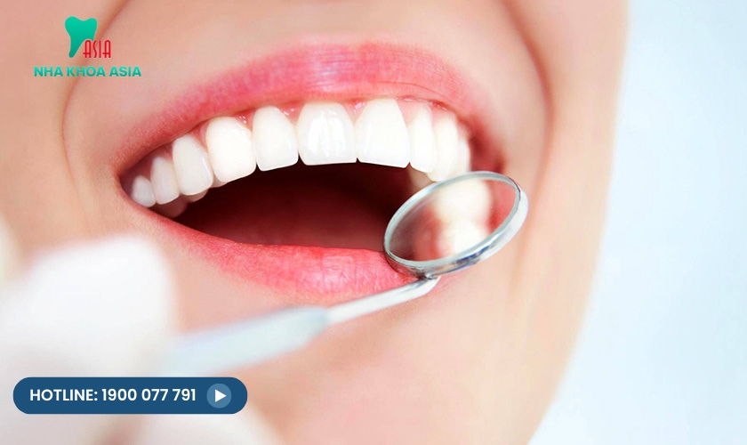 Tẩy trắng răng bleach bright là gì?