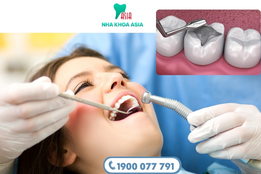Quy trình trám răng Composite tại Nha khoa Asia đảm bảo an toàn, hiệu quả và thẩm mỹ cao