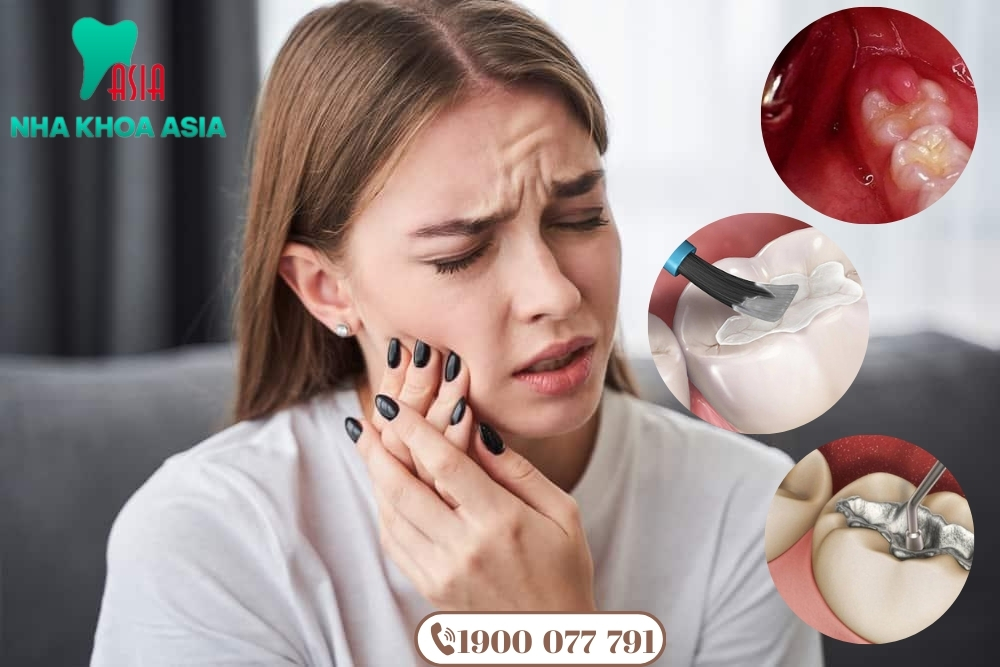 Trám răng xong bị nhức có thể do vật liệu trám, kỹ thuật trám không đúng hoặc tổn thương răng