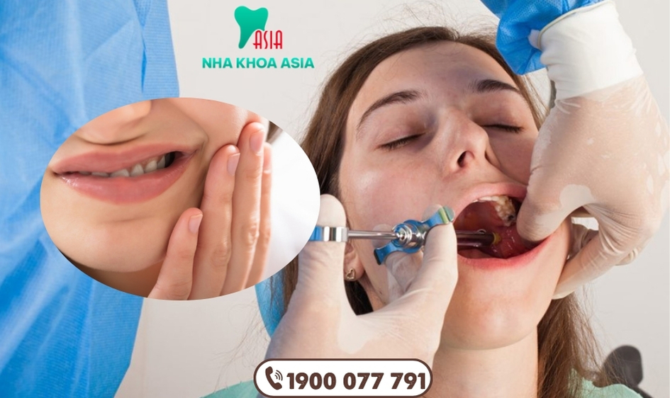 Trám răng xong bị nhức thường không nguy hiểm, nhưng nếu kéo dài có thể là dấu hiệu của vấn đề nghiêm trọng